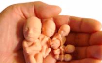 Medicinski prekid trudnoće - efikasnost i rizici
